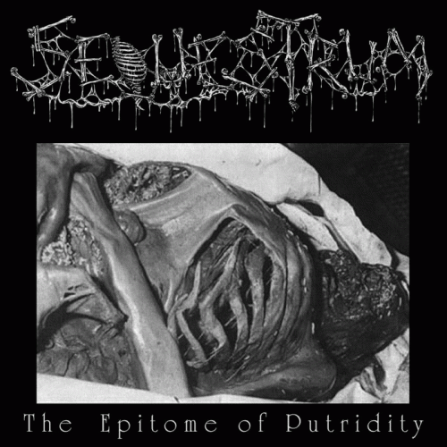 Sequestrum : The Epitome of Putridity